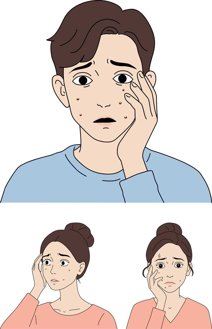 얼굴 여드름 원인 정보성 디자인 할 때